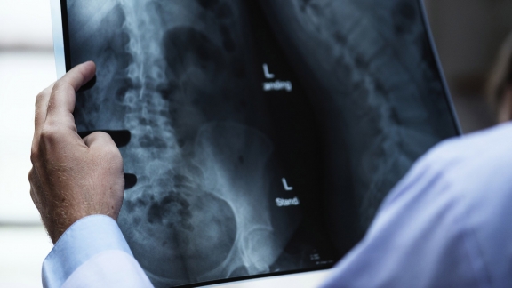 Protection contre les rayons X dans le milieu médical : nouvelles